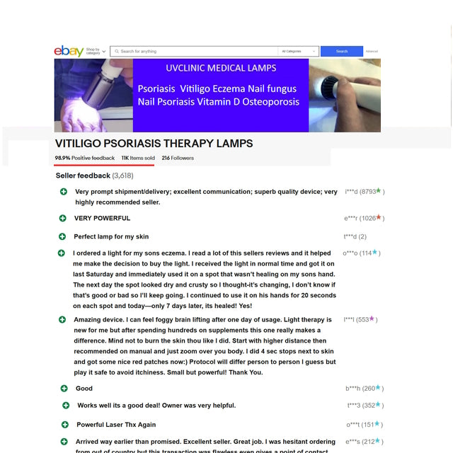 Lampada per il trattamento di psoriasi, eczema e vitiligine