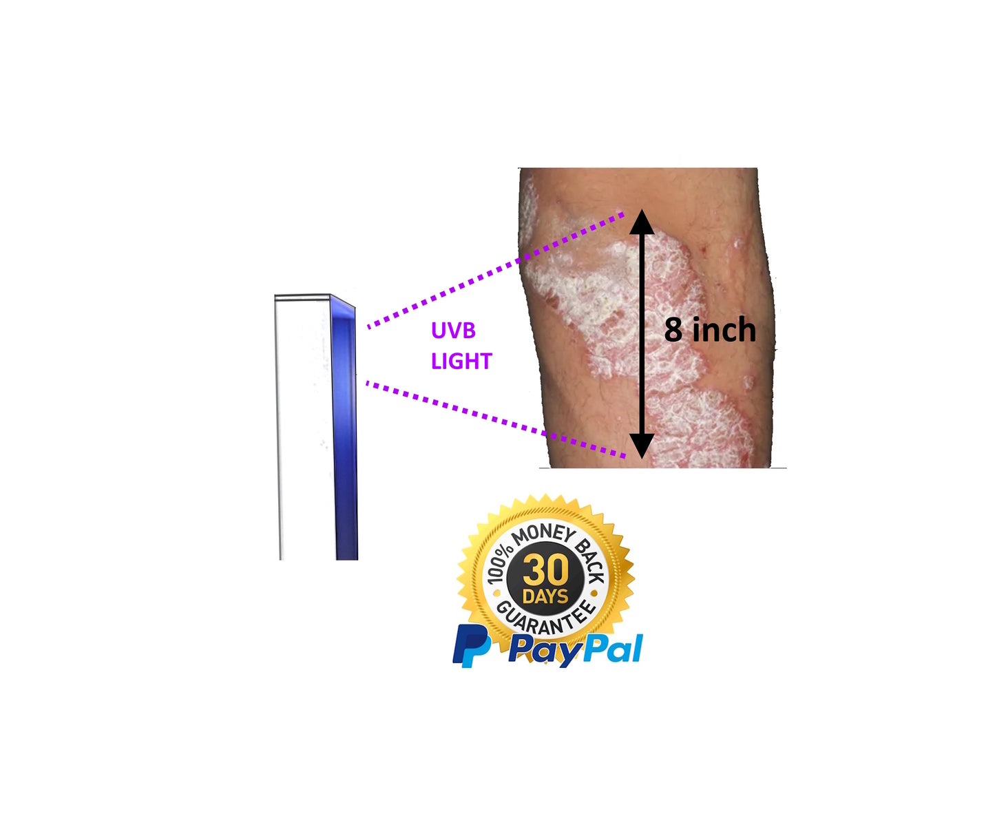 Psoriasis Eczema Vitiligo Phototherapy Lamp 8X8 inch in 20 seconds