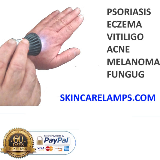 Skin treatment lamp USB 5 watt