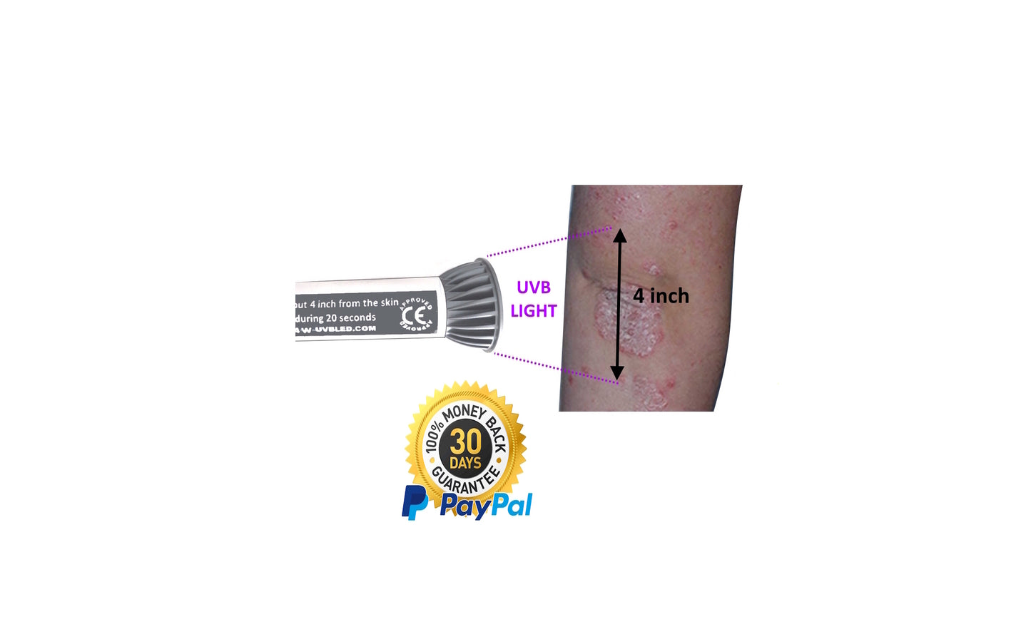 Psoriasis Eczema Vitiligo Phototherapy Lamp 4X4 inch in 20 seconds