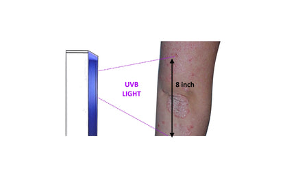 Psoriasis Eczema Vitiligo Phototherapy Lamp 8X8 inch in 20 seconds