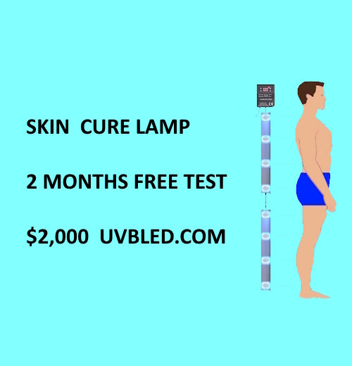 160 WATT FULL BODY SKIN CURE LAMP