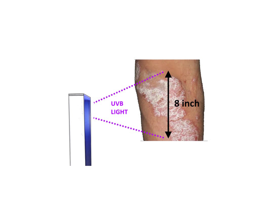 Lampe de thérapie cutanée pour tout le corps pour le psoriasis, le vitiligo et l’eczéma.